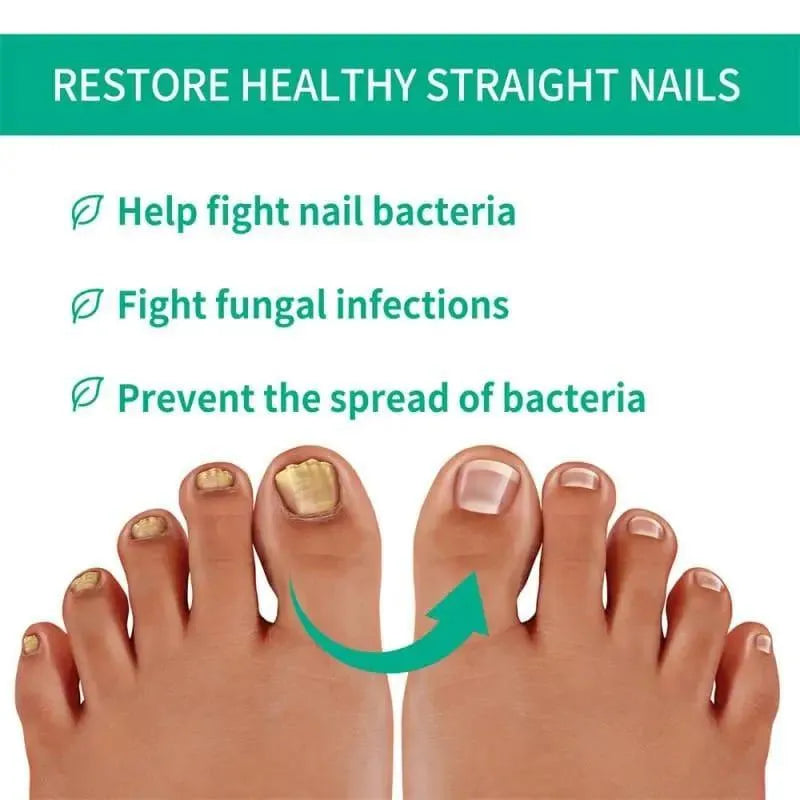 Nail Fungal Treatment Nail Repair Essences Serum