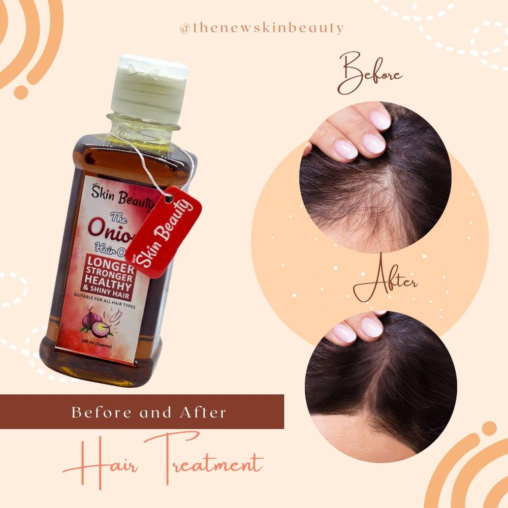 Onion Hair Oil - 100ml