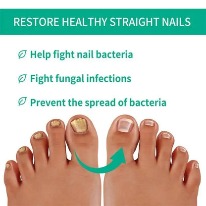 Nail Fungal Treatment Nail Repair Essences Serum