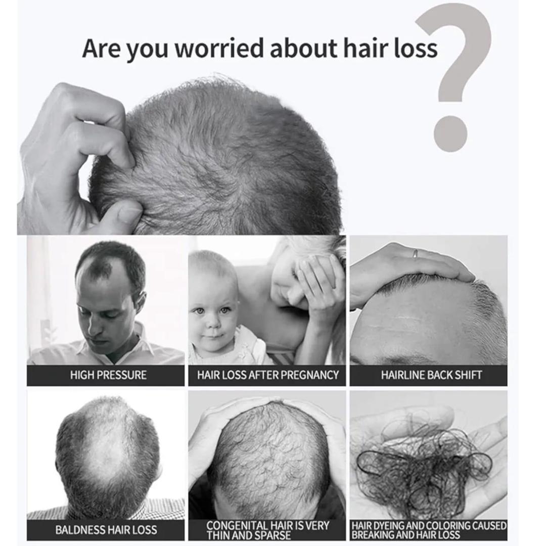 Anti-Hair Loss Hair Tonic